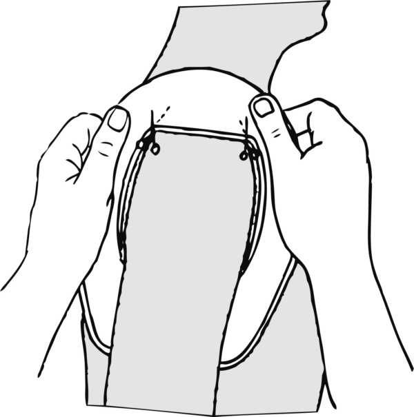 Guide scapulo-humeral shoulder cuff orthosis